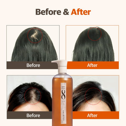 Matsutake Stem Cell Anti-Hair Loss Shampoo 16.2 OZ